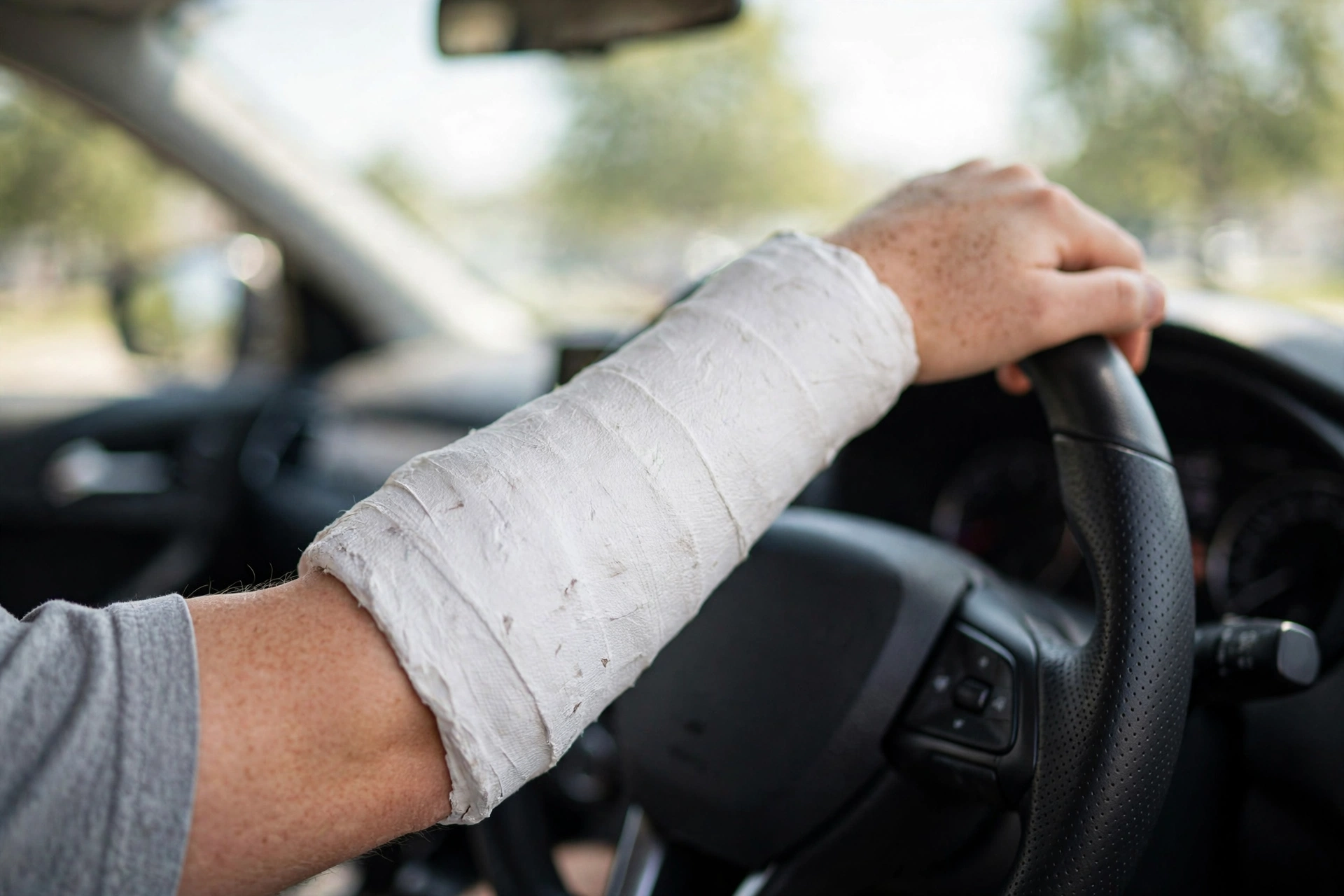 can-i-drive-with-a-broken-arm-uk